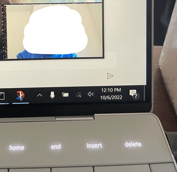 Graphical glitch in the box with my self portrait - Microsoft Q&A