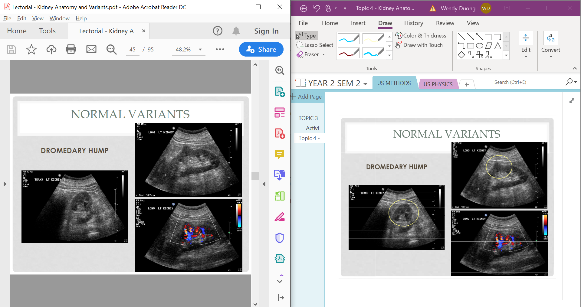 OneNote 2016 - Open File as Printout, Images have multiple lines across ...